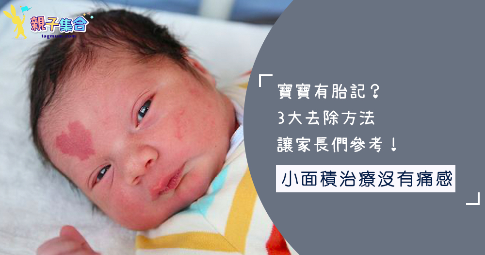 寶寶有胎記?3大去除方法讓家長們參考!